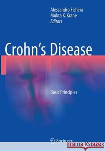 Crohn's Disease: Basic Principles Fichera, Alessandro 9783319356273 Springer