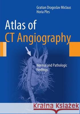 Atlas of CT Angiography: Normal and Pathologic Findings Miclaus, Gratian Dragoslav 9783319356884 Springer