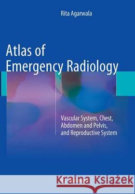 Atlas of Emergency Radiology: Vascular System, Chest, Abdomen and Pelvis, and Reproductive System Agarwala, Rita 9783319357706
