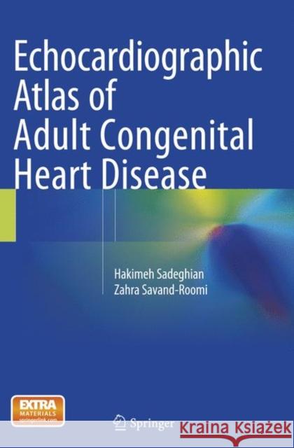 Echocardiographic Atlas of Adult Congenital Heart Disease Sadeghian, Hakimeh; Savand-Roomi, Zahra 9783319360720 Springer