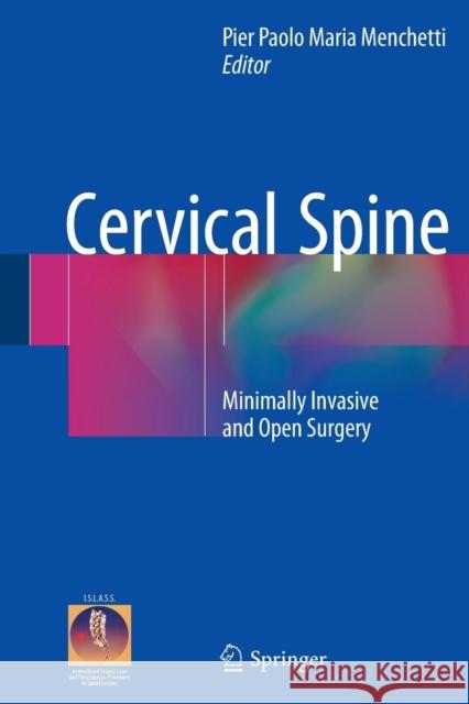 Cervical Spine: Minimally Invasive and Open Surgery Menchetti, Pier Paolo Maria 9783319361024 Springer