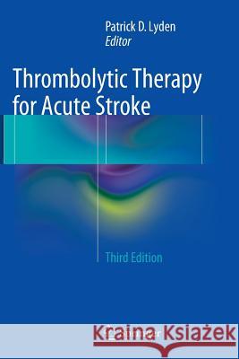 Thrombolytic Therapy for Acute Stroke Patrick Lyden 9783319376448 Springer