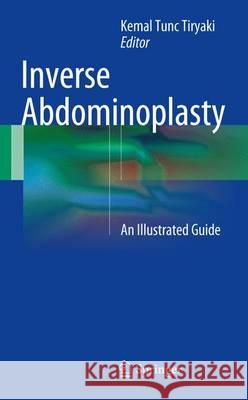 Inverse Abdominoplasty: An Illustrated Guide Tiryaki, Kemal Tunc 9783319393087 Springer