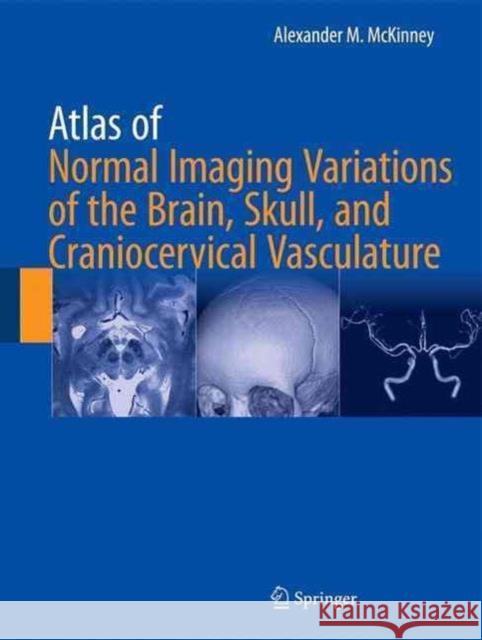 Atlas of Normal Imaging Variations of the Brain, Skull, and Craniocervical Vasculature McKinney, Alexander M. 9783319397894 Springer