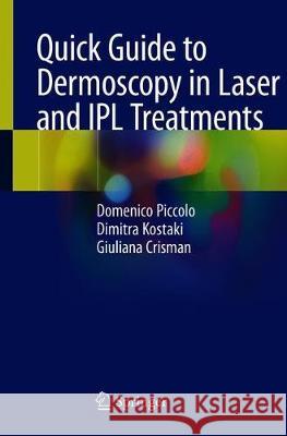 Quick Guide to Dermoscopy in Laser and Ipl Treatments Piccolo, Domenico 9783319416328 Springer