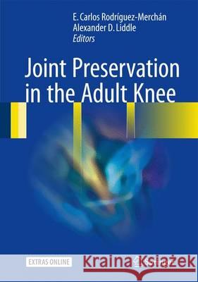 Joint Preservation in the Adult Knee E. Carlos Rodriguez-Merchan Alexander D. Liddle 9783319418070