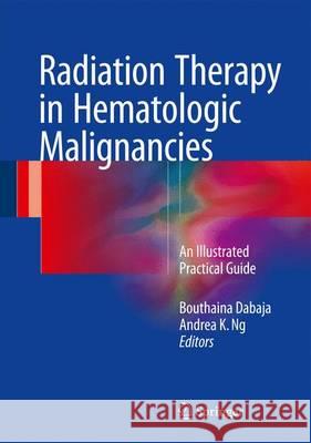 Radiation Therapy in Hematologic Malignancies: An Illustrated Practical Guide Dabaja, Bouthaina Shbib 9783319426136 Springer