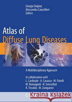 Atlas of Diffuse Lung Diseases: A Multidisciplinary Approach Dalpiaz, Giorgia 9783319427508 Springer