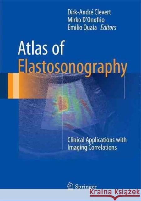 Atlas of Elastosonography: Clinical Applications with Imaging Correlations Clevert, Dirk-André 9783319441993 Springer