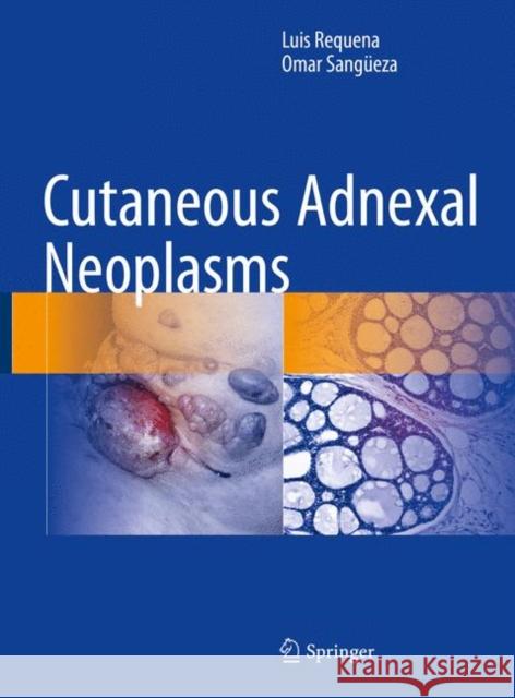 Cutaneous Adnexal Neoplasms Luis Requena Omar Sangueza 9783319457031 Springer