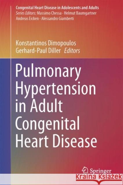 Pulmonary Hypertension in Adult Congenital Heart Disease Konstantinos Dimopoulos Gerhard-Paul Diller 9783319460260 Springer