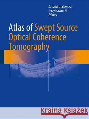 Atlas of Swept Source Optical Coherence Tomography Jerzy Nawrocki Zofia Michalewska 9783319498393 Springer