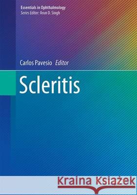 Scleritis Carlos Pavesio 9783319499130 Springer