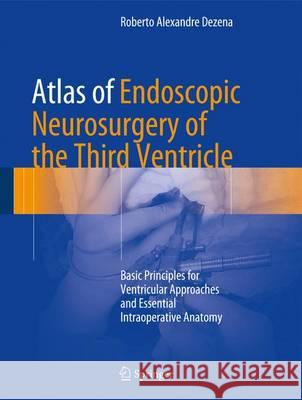 Atlas of Endoscopic Neurosurgery of the Third Ventricle: Basic Principles for Ventricular Approaches and Essential Intraoperative Anatomy Dezena, Roberto Alexandre 9783319500676 Springer