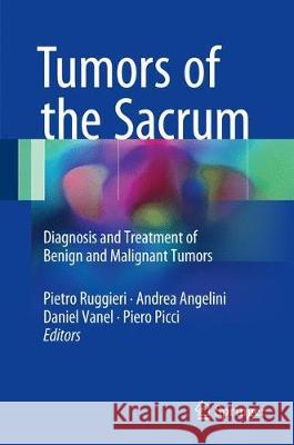 Tumors of the Sacrum: Diagnosis and Treatment of Benign and Malignant Tumors Ruggieri, Pietro 9783319512006