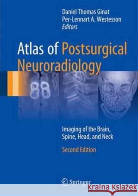 Atlas of Postsurgical Neuroradiology: Imaging of the Brain, Spine, Head, and Neck Ginat, Daniel Thomas 9783319523408