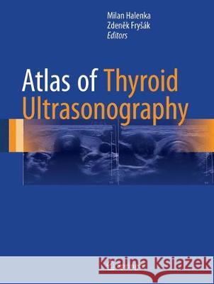 Atlas of Thyroid Ultrasonography Milan Halenka Zden K. Fr 9783319537580 Springer