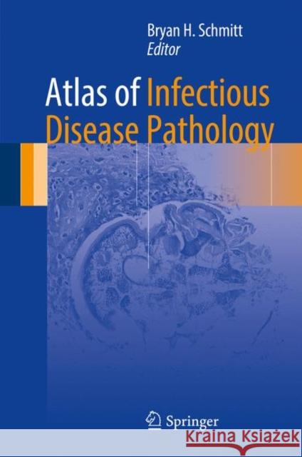 Atlas of Infectious Disease Pathology Bryan Schmitt 9783319547015 Springer