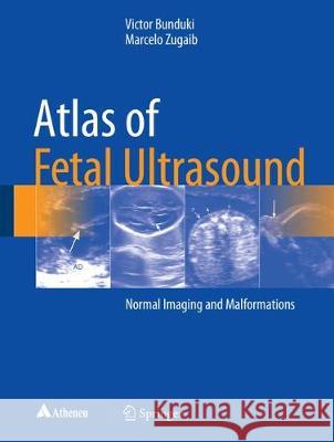 Atlas of Fetal Ultrasound: Normal Imaging and Malformations Bunduki, Victor 9783319547978 Springer