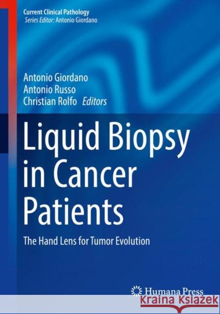 Liquid Biopsy in Cancer Patients: The Hand Lens for Tumor Evolution Russo, Antonio 9783319556598 Humana Press