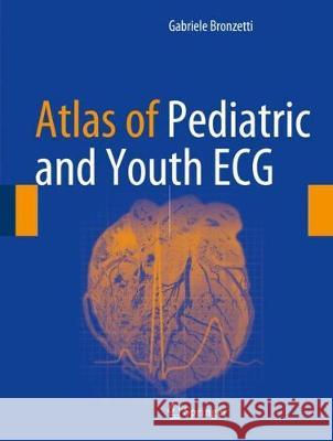 Atlas of Pediatric and Youth ECG Gabriele Bronzetti 9783319571010 Springer