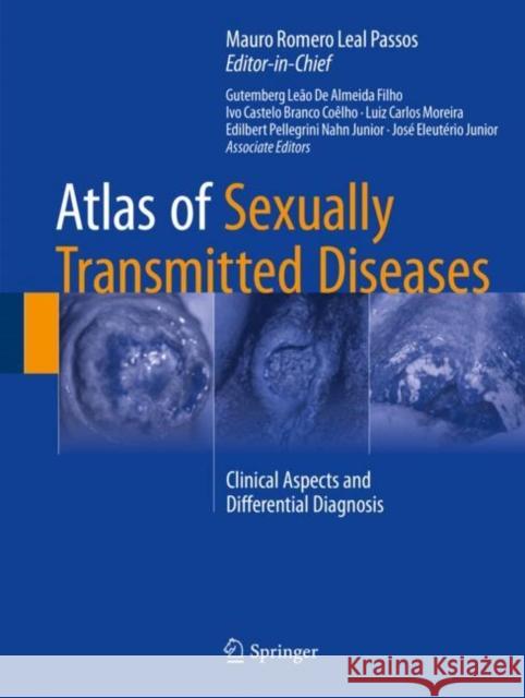 Atlas of Sexually Transmitted Diseases: Clinical Aspects and Differential Diagnosis Passos, Mauro Romero Leal 9783319574684 Springer