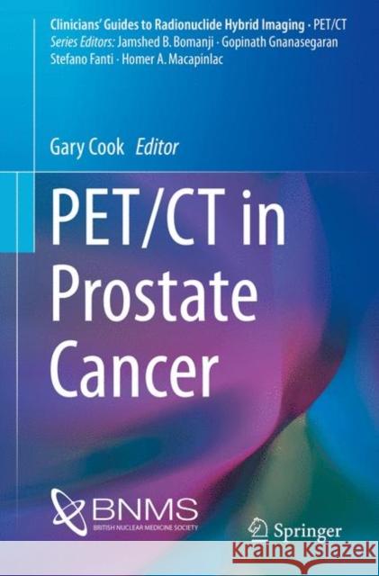 Pet/CT in Prostate Cancer Cook, Gary 9783319576237