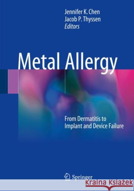 Metal Allergy: From Dermatitis to Implant and Device Failure Chen, Jennifer K. 9783319585024 Springer