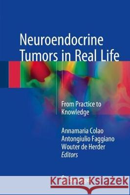 Neuroendocrine Tumors in Real Life: From Practice to Knowledge Colao, Annamaria 9783319590226 Springer