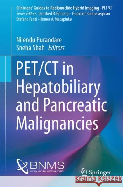 Pet/CT in Hepatobiliary and Pancreatic Malignancies Purandare, Nilendu 9783319605067 Springer