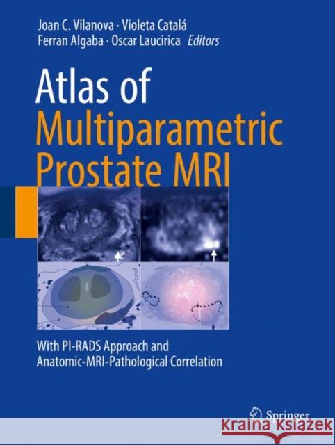 Atlas of Multiparametric Prostate MRI: With Pi-Rads Approach and Anatomic-Mri-Pathological Correlation Vilanova, Joan C. 9783319617855 Springer