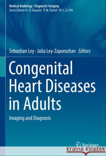 Congenital Heart Diseases in Adults: Imaging and Diagnosis Ley, Sebastian 9783319618869 Springer