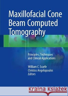 Maxillofacial Cone Beam Computed Tomography: Principles, Techniques and Clinical Applications Scarfe, William C. 9783319620596 Springer