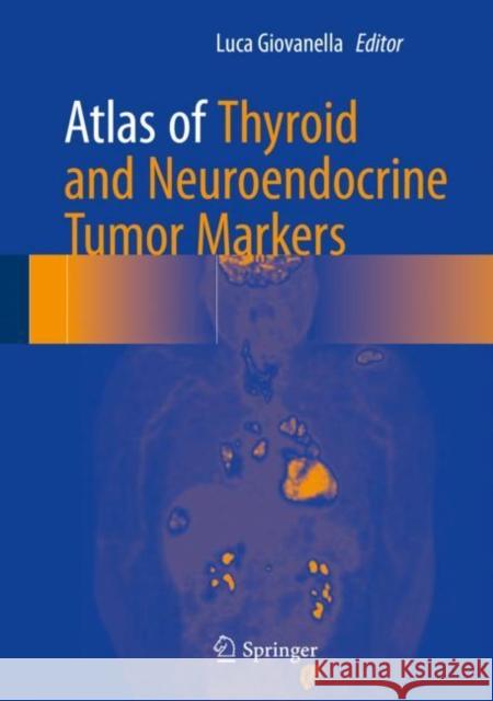 Atlas of Thyroid and Neuroendocrine Tumor Markers Luca Giovanella 9783319625058 Springer