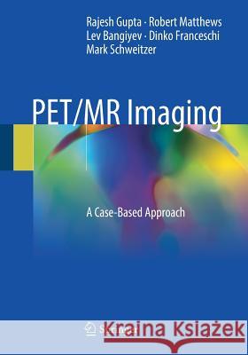 Pet/MR Imaging: A Case-Based Approach Gupta, Rajesh 9783319651057 Springer