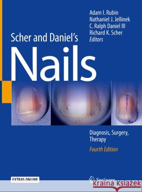 Scher and Daniel's Nails: Diagnosis, Surgery, Therapy Rubin, Adam I. 9783319656472 Springer International Publishing AG