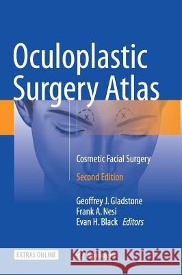 Oculoplastic Surgery Atlas: Cosmetic Facial Surgery Gladstone, Geoffrey J. 9783319673301 Springer