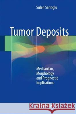 Tumor Deposits: Mechanism, Morphology and Prognostic Implications Sarioglu, Sulen 9783319685816 Springer