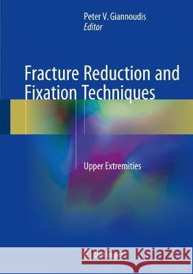 Fracture Reduction and Fixation Techniques: Upper Extremities Giannoudis, Peter V. 9783319686271
