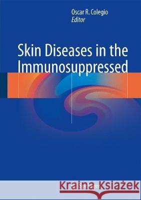 Skin Diseases in the Immunosuppressed Oscar R. Colegio 9783319687889 Springer
