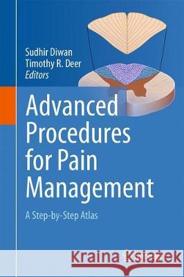 Advanced Procedures for Pain Management: A Step-By-Step Atlas Diwan, Sudhir 9783319688398 Springer