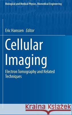 Cellular Imaging: Electron Tomography and Related Techniques Hanssen, Eric 9783319689951