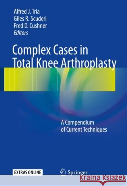 Complex Cases in Total Knee Arthroplasty: A Compendium of Current Techniques [With Online Access] Tria, Alfred J. 9783319693798