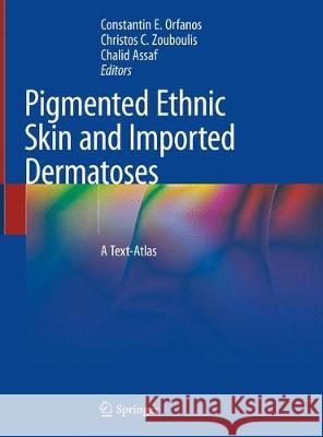 Pigmented Ethnic Skin and Imported Dermatoses: A Text-Atlas Orfanos, Constantin E. 9783319694214