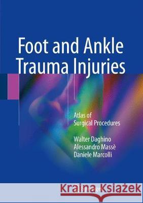 Foot and Ankle Trauma Injuries: Atlas of Surgical Procedures Daghino, Walter 9783319696164 Springer