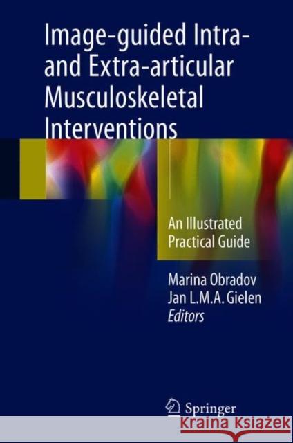 Image-Guided Intra- And Extra-Articular Musculoskeletal Interventions: An Illustrated Practical Guide Obradov, Marina 9783319698939 Springer