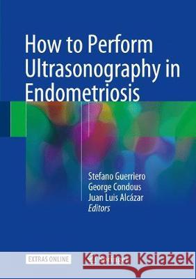 How to Perform Ultrasonography in Endometriosis Stefano Guerriero George Condous Juan Luis Alcazar 9783319711379 Springer