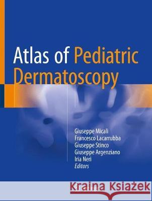 Atlas of Pediatric Dermatoscopy Giuseppe Micali Francesco Lacarrubba Stinco Giuseppe 9783319711676 Springer