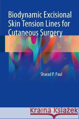 Biodynamic Excisional Skin Tension Lines for Cutaneous Surgery Sharad P. Paul 9783319714943 Springer