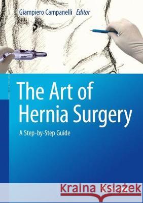 The Art of Hernia Surgery: A Step-By-Step Guide Campanelli, Giampiero 9783319726243 Springer